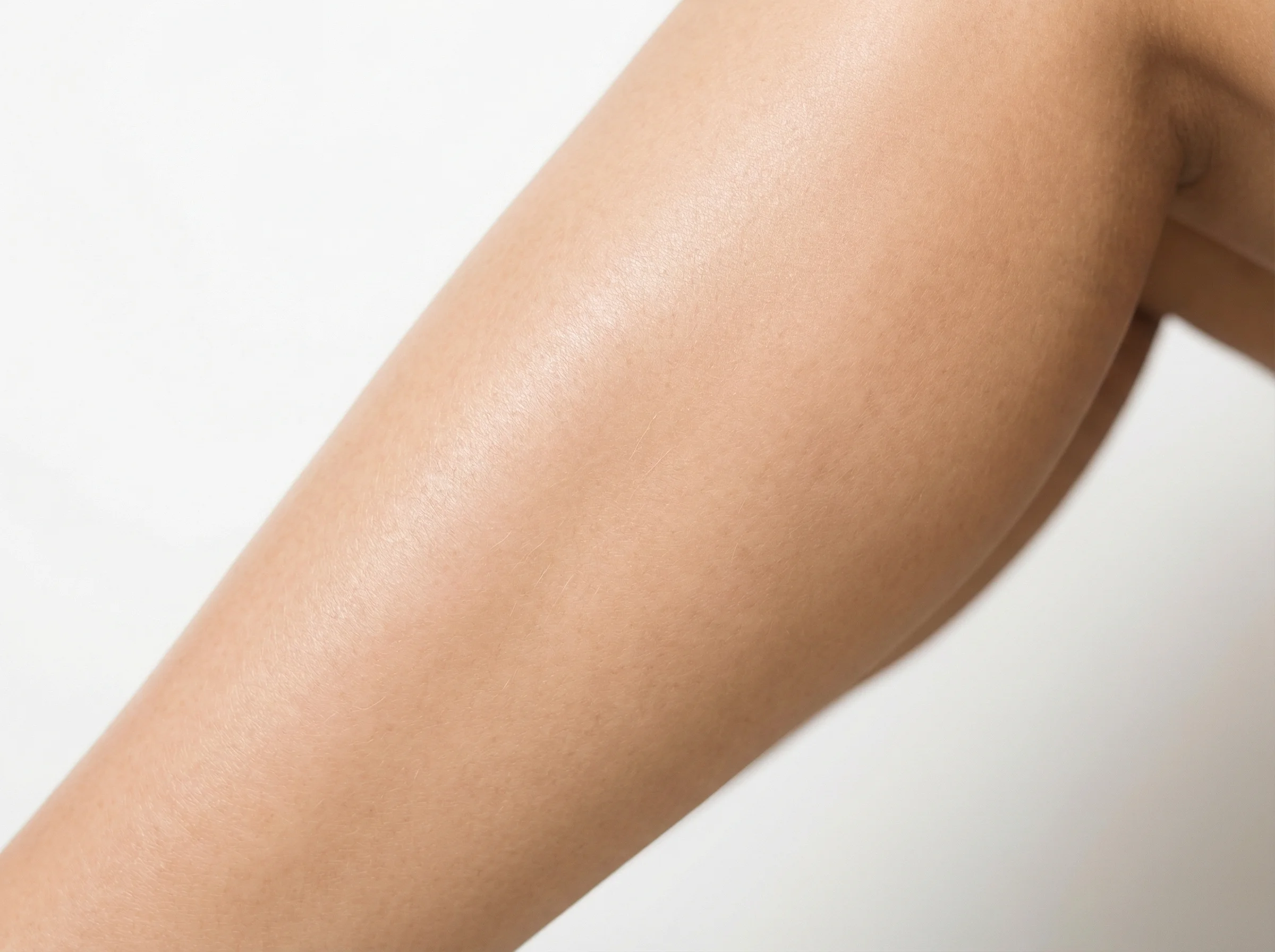 IPL permanent hair removal results Month 3 Pixie PK Pakistan