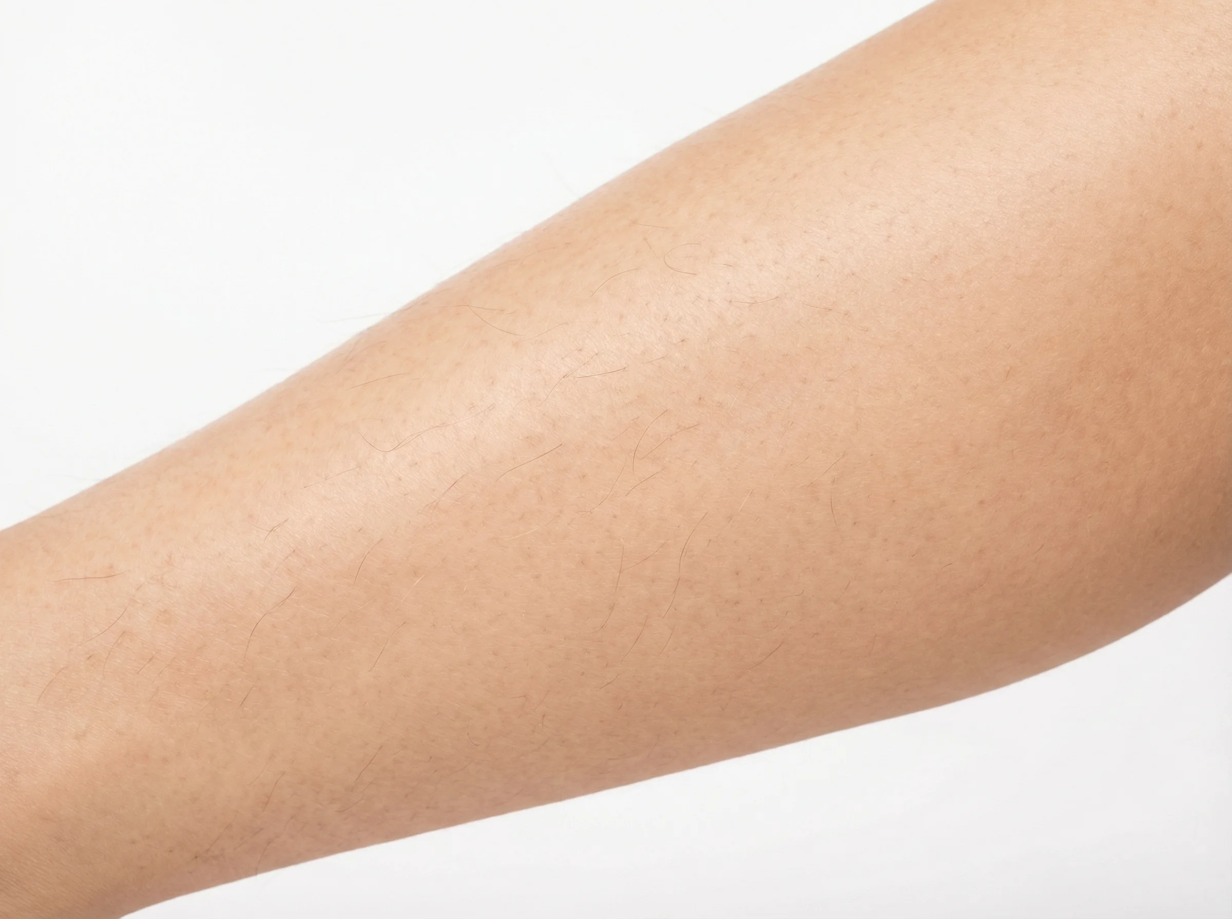 IPL hair removal Month 2 once a week visible results